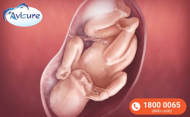 Khám thai định kỳ giúp đánh giá sự phát triển bình thường của thai nhi